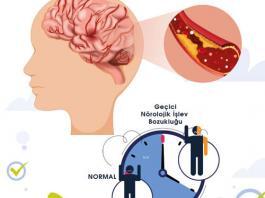 Geçici İskemik Atak (TİA : GİA)