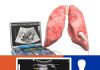 Toraks (Akciğer) Ultrasonografisi (PoCUS)
