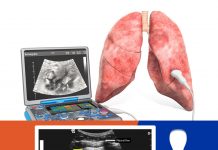 Toraks (Akciğer) Ultrasonografisi (PoCUS)