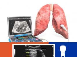 Toraks (Akciğer) Ultrasonografisi (PoCUS)