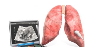 Toraks (Akciğer) Ultrasonografisi (PoCUS)