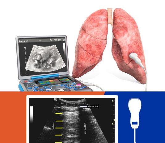 Toraks (Akciğer) Ultrasonografisi (PoCUS)