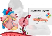 Kardiyak Troponinlerin Klinik Önemi