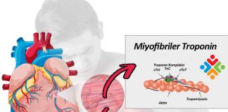 Kardiyak Troponinlerin Klinik Önemi