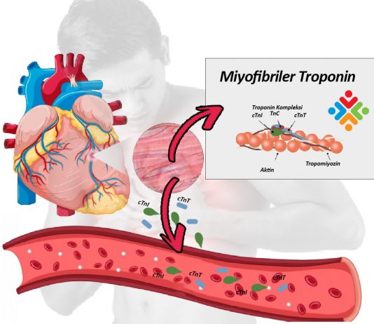Kardiyak Troponinlerin Klinik Önemi