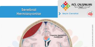 Serebral Herniasyonlar Acil Yaklaşım