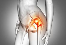 Proksimal Femur Kırıkları Acil Yaklaşım