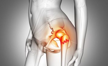 Proksimal Femur Kırıkları Acil Yaklaşım