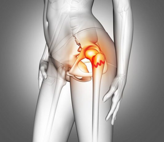 Proksimal Femur Kırıkları Acil Yaklaşım