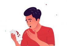 Hemoptizi Acil Yaklaşımı