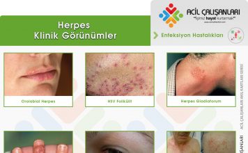 Herpes Enfeksiyonları