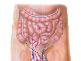 İnguinal Herni (Kasık Fıtığı ) Acil Yaklaşım
