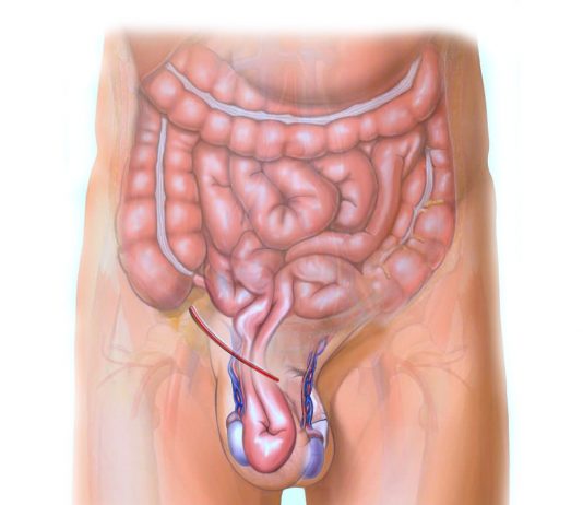 İnguinal Herni (Kasık Fıtığı ) Acil Yaklaşım