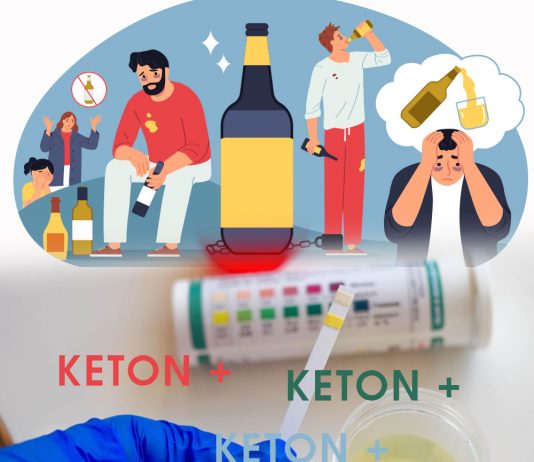 Alkolik Ketoasidoz Acil Yaklaşım