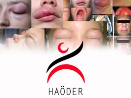 Herediter Anjioödem- HAÖDER