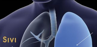 Plevral Efüzyon Acil Yaklaşım