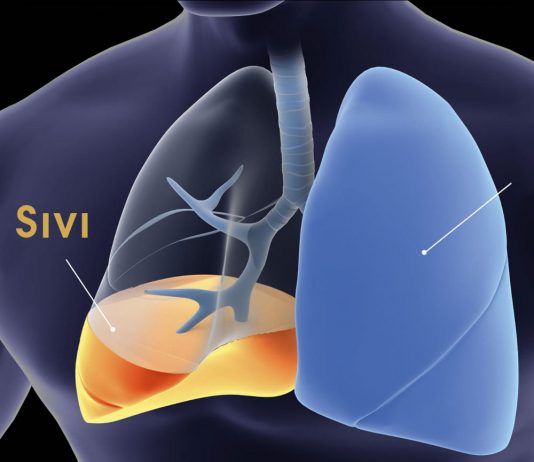 Plevral Efüzyon Acil Yaklaşım