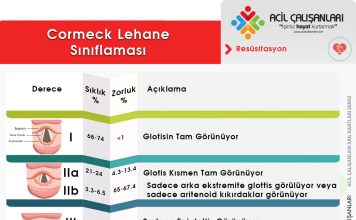 Cormeck Lehane Sınıflaması Akıl Kartı