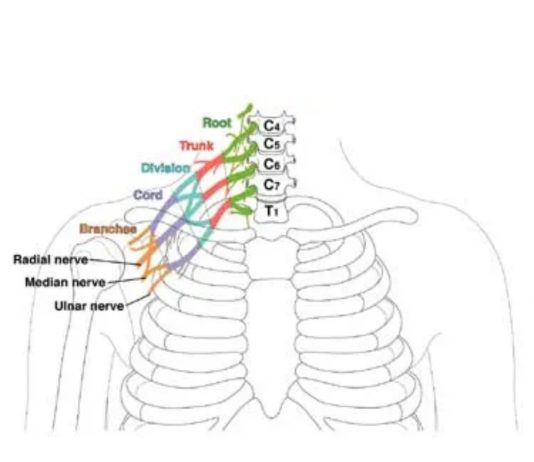 Brakiyal Pleksus Yaralanması