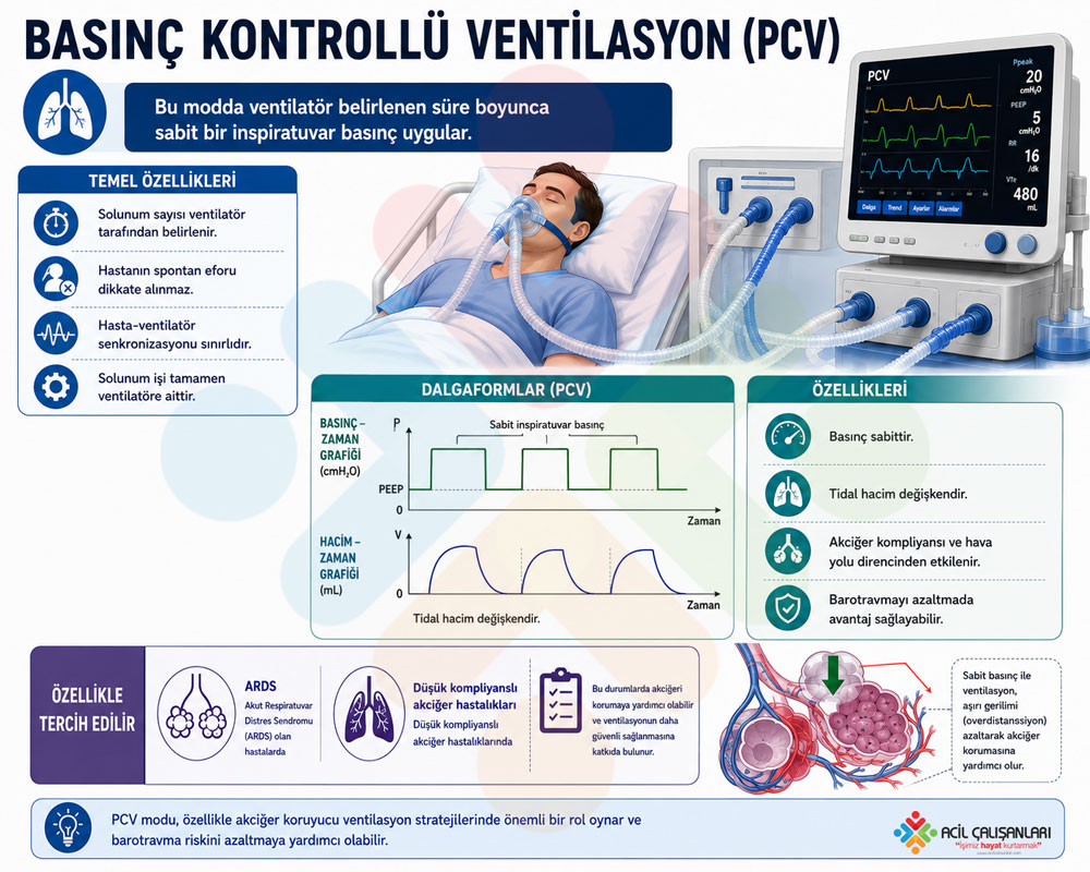 Basınç Kontrollü Ventilasyon