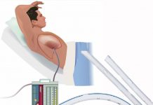 Göğüs Tüpü Takılması (Tüp Torakostomi)