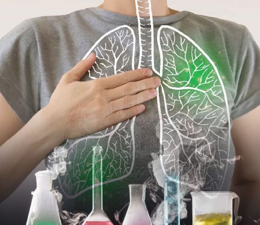 Toksik İnhalasyonlara Genel Yaklaşım