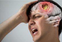 Beyin Apsesi Acil Yaklaşım