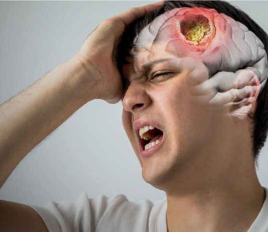 Beyin Apsesi Acil Yaklaşım