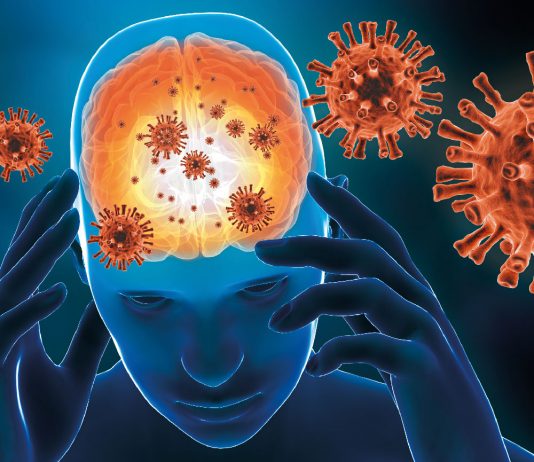 Ensefalit Acil Yaklaşım