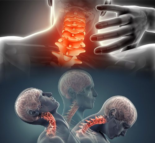 Travma Sonrası Servikal Omurga Değerlendirmesi