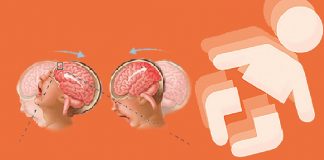 Sarsılmış Bebek Sendromu Acil Yaklaşım