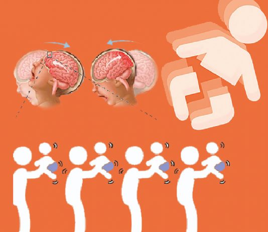 Sarsılmış Bebek Sendromu Acil Yaklaşım