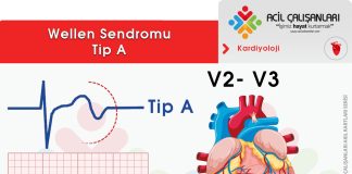 Wellen Sendromu Acil Yaklaşım