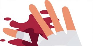 Parmak Amputasyonları Acil Yaklaşım