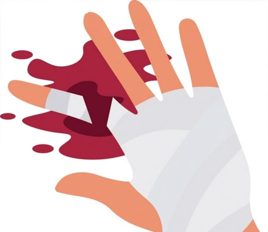 Parmak Amputasyonları Acil Yaklaşım