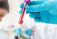 Yetişkinler İçin Normal Laboratuvar Referans Aralıkları