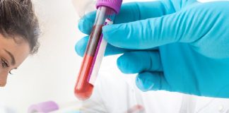 Yetişkinler İçin Normal Laboratuvar Referans Aralıkları