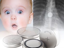 Pil Yutulması Acil Yaklaşım