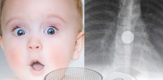 Pil Yutulması Acil Yaklaşım