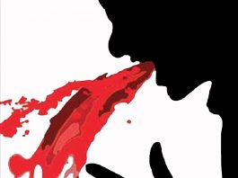 Üst Gastrointesinal Sistem Kanamaları