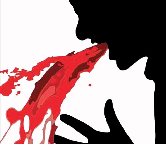 Üst Gastrointesinal Sistem Kanamaları