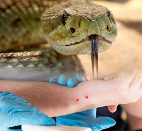 Yılan Isırması Acil Yaklaşım