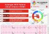 Aslanger EKG Paterni Erken İnferior STEMİ