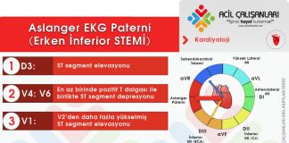 Aslanger EKG Paterni Erken İnferior STEMİ