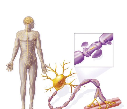Güllien-Barre Sendromu (GBS)