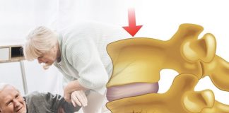 Vertebral Kompresyon Kırığı