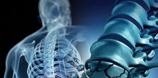 Vertebra Fraktürlerine Genel Yaklaşım