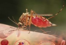 Sıtma Acil Yaklaşım