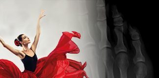 Dansçı (Pseudo Jones) Kırığı