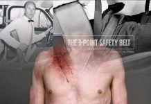 Emniyet Kemeri Yaralanması